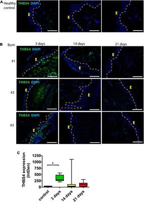 Thrombospondin-4 Is a Soluble Dermal Inflammatory Signal That Selectively Promotes <mark class="highlighted">Fibroblast Migration</mark> and Keratinocyte Proliferation for Skin Regeneration and Wound Healing